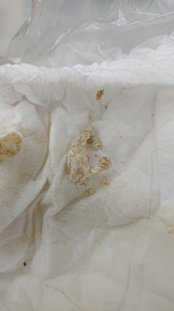 汚いので画像閲覧要注意です！ - 今、保育園でロタウィルスか- Yahoo!知恵袋