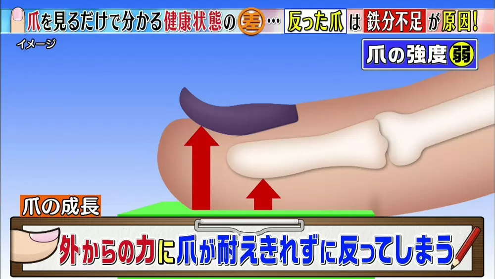 子どもの爪トラブル 前編 〜爪の相談は小児科や皮膚科へ〜 - 小児科オンラインジャーナル