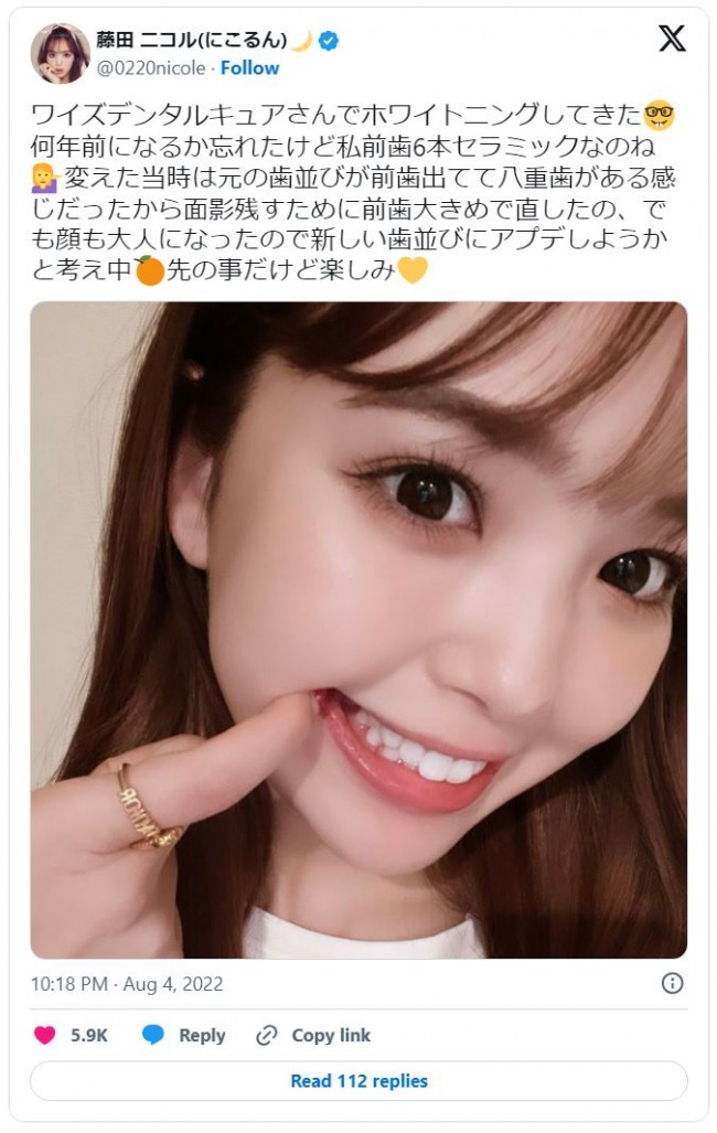 大きい前歯を治療して笑顔を取り戻そう！韓国歯科 ミニッシュ歯科病院 本院•江南店 ブログ