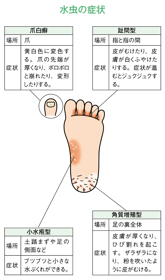 足つぼマットのおすすめ人気ランキング【2024年】 | マイベスト