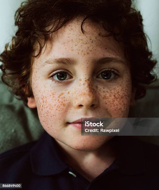 そばかすは思春期を過ぎれば消える？ 消えない場合の治療法は？ - シミ取り・肝斑・毛穴治療の美容医療情報口コミ広場