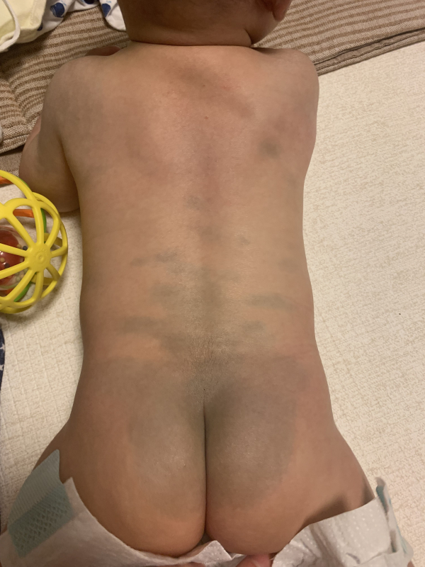 赤ちゃんの歯磨きはガーゼから 磨き方と注意すべき事