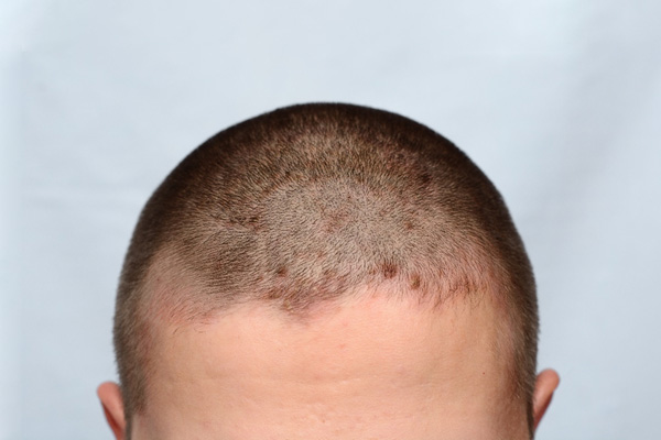 週刊「赤子しぐさ」 8困っているわけではないけれど「お頭かかえ」マイナビニュース