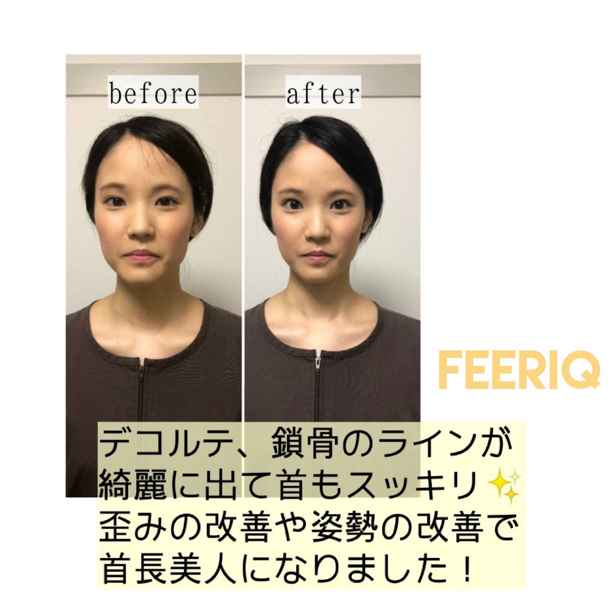 美容鍼灸サロン FEERIQ フェリーク(新宿区 | 新宿御苑前駅)の口コミ・評判。